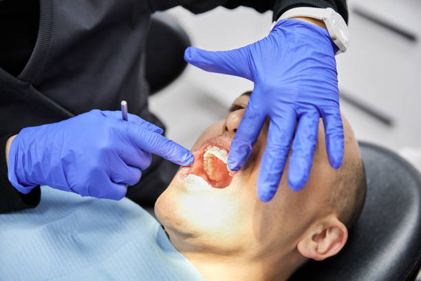 Best Emergency Dental Extractions in Shelbyville, TN